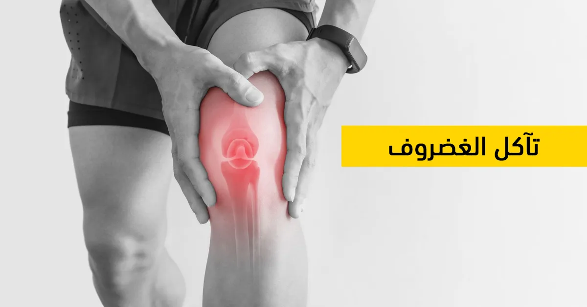 تآكل الغضروف